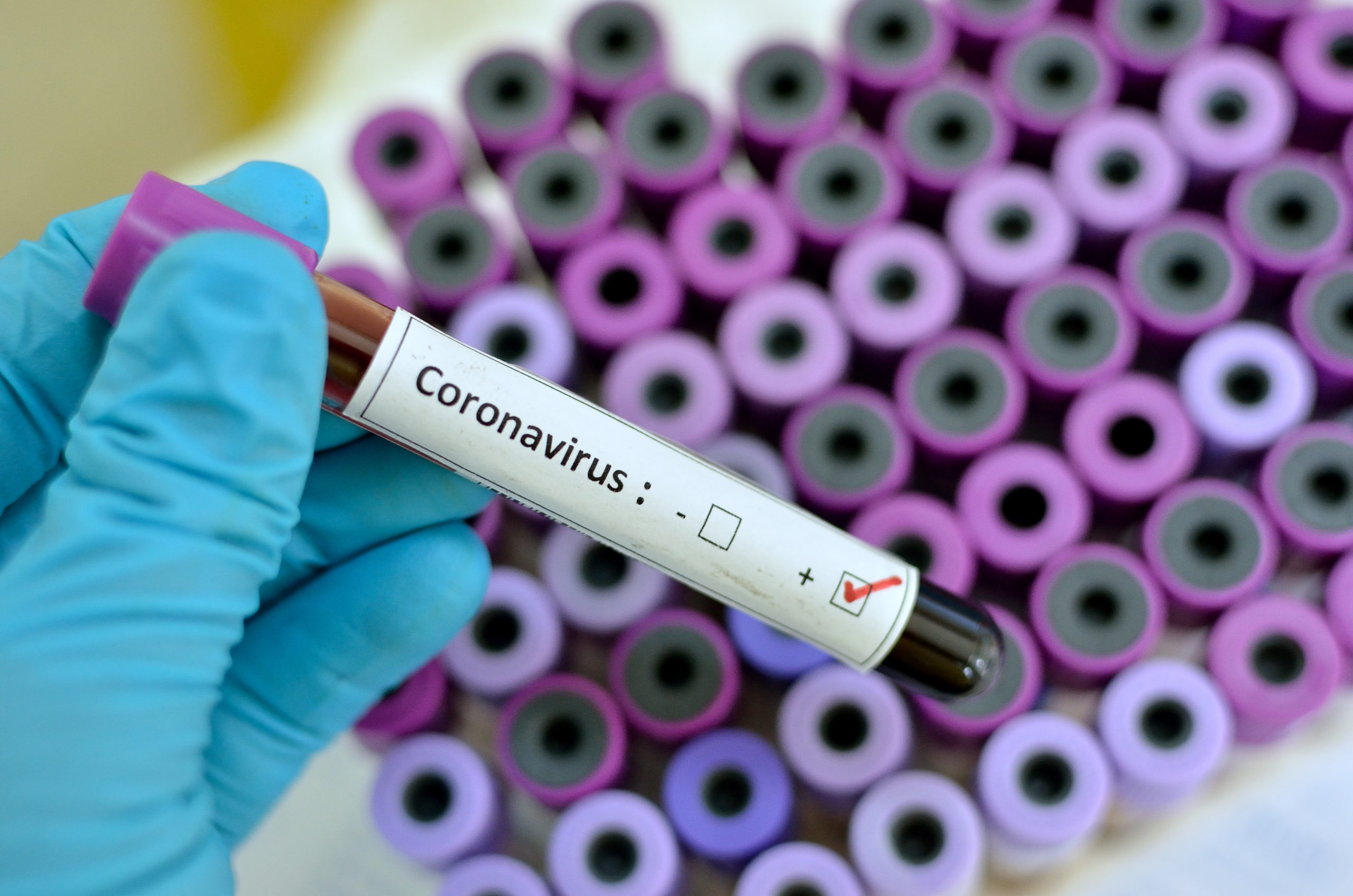 Minnesota Schools Receive Guidance on Handling Coronavirus